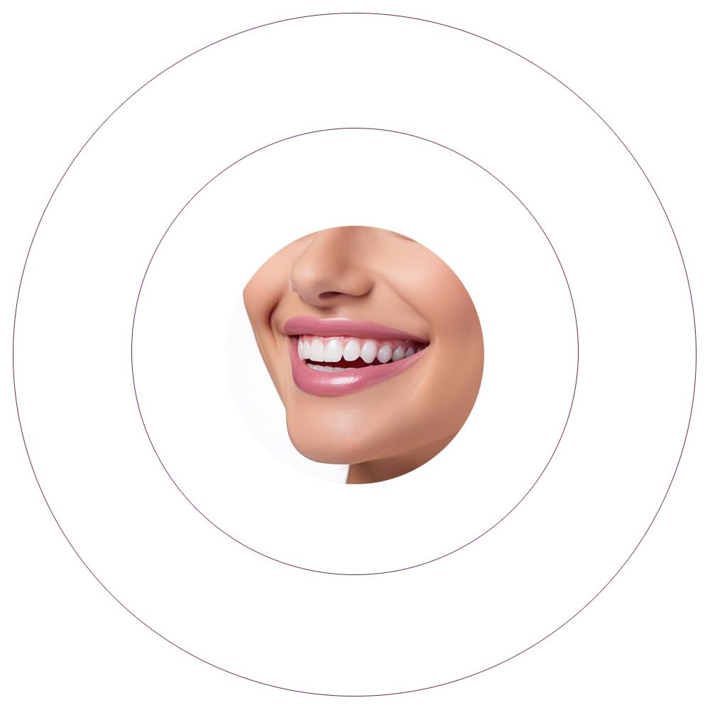 cercle dents